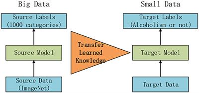 Alcoholism Identification Based on an AlexNet Transfer Learning Model